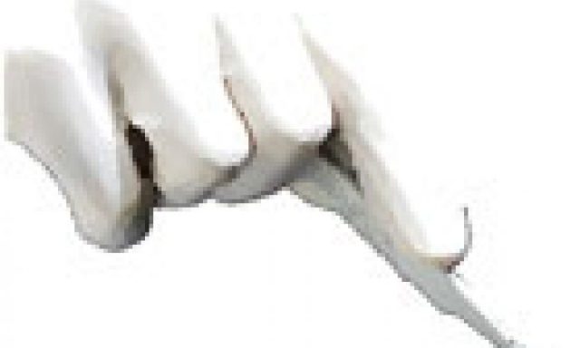 ΞΕΡΡΑ ΓΚΡΑΤΣΙΑ-ΠΑΤΡΙΤΣΙΑ